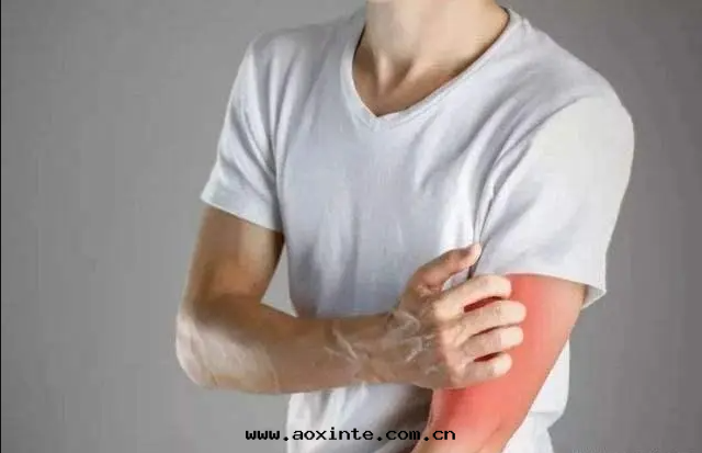 甲醛超标(biāo)引起(qǐ)皮膚过(guò)敏